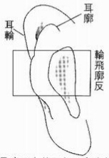 这是“轮飞廓反”的耳相，主童年运程不顺